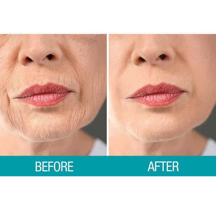 Crepe Be Gone Firming Neck Cream 3 oz. (Pack of 2)