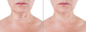 Crepe Be Gone Skin Firming Neck Mask (Pack of 2)