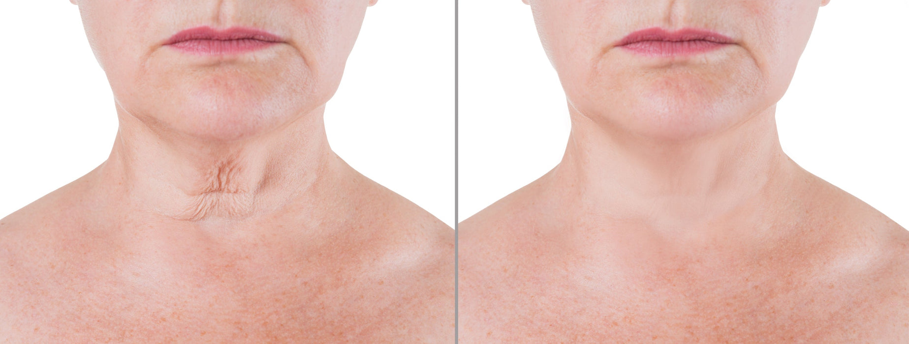 Crepe Be Gone Skin Firming Neck Mask (Pack of 2)