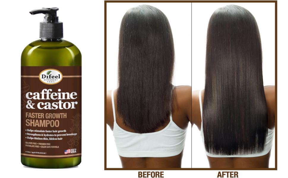 Difeel 3-PC Caffeine & Castor Shampoo, Conditioner & Hair Oil for Faster Hair Growth - with 33.8 oz. Shampoo, 33.8 oz. Conditioner & 7.78 oz. Hair Oil