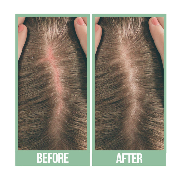 Difeel Scalp Care Premium Natural Hair Oil - Tea Tree Oil 8 oz.