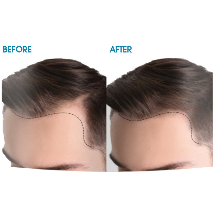 Difeel Mens 2-in-1 Ultra Growth Shampoo & Conditioner 12 oz.