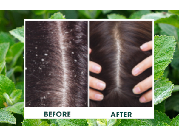 Difeel Rosemary & Mint Foaming Mousse 8 Ounces