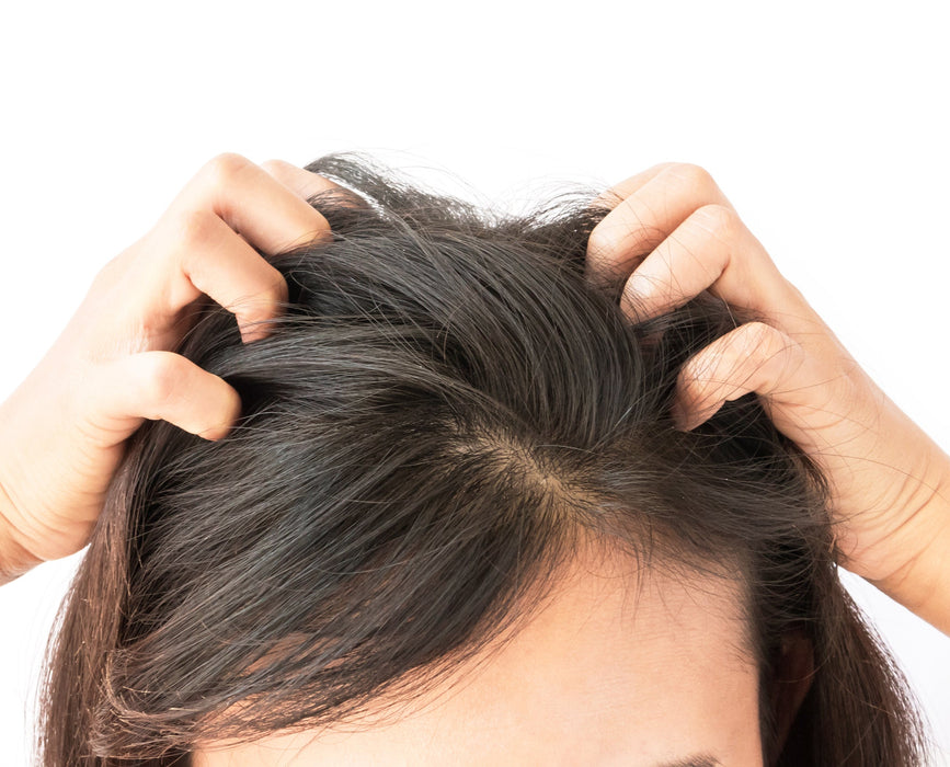 Difeel Scalp Care Premium Natural Hair Oil - Tea Tree Oil 8 oz.